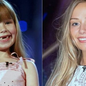 BGT CHAMPIONS CONNIE TALBOT BEFORE AND AFTER