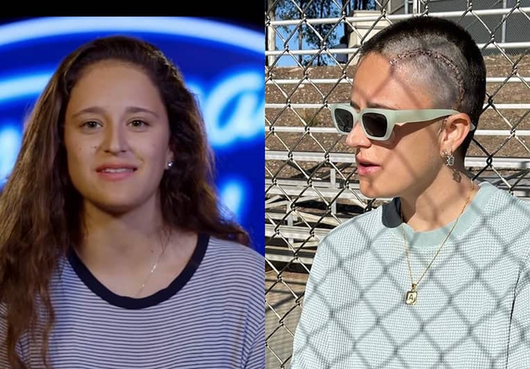 Avalon-Young-Brain-Cancer-Avalon-Young-American-Idol