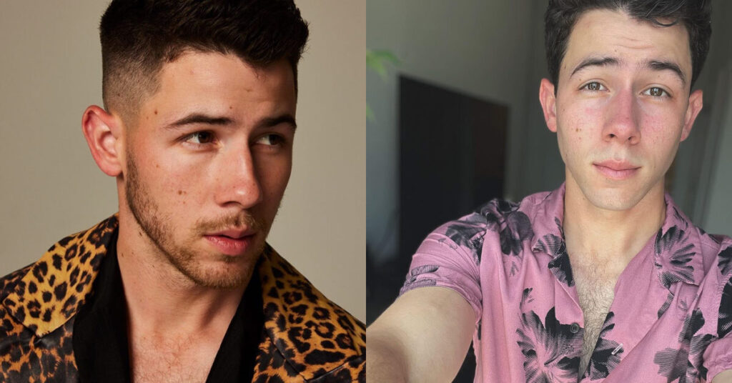 Nick Jonas