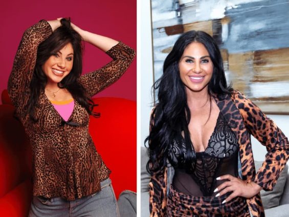 mikalah gordon plastic surgery Image 5