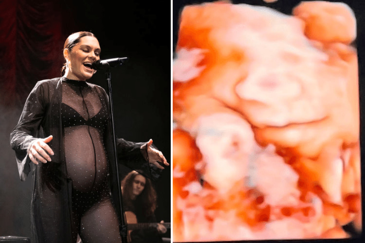Jessie J Performs At O2 Shepherds Bush Empire